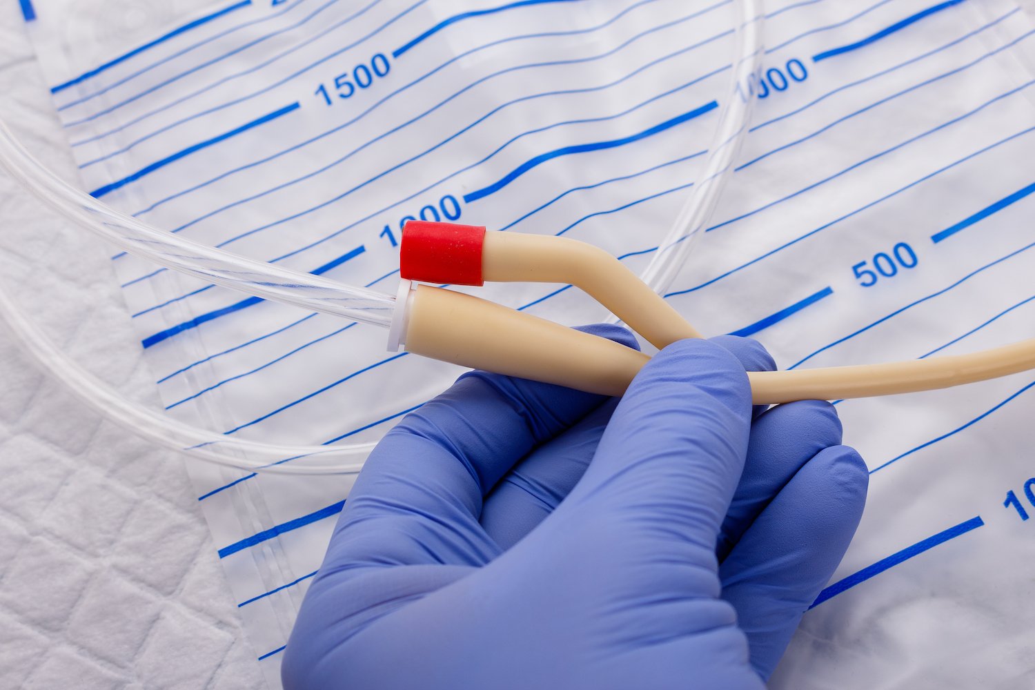 Nurse Inflates Urinary Catheter Bulb With Leg Drainage Bag On Sterile Field